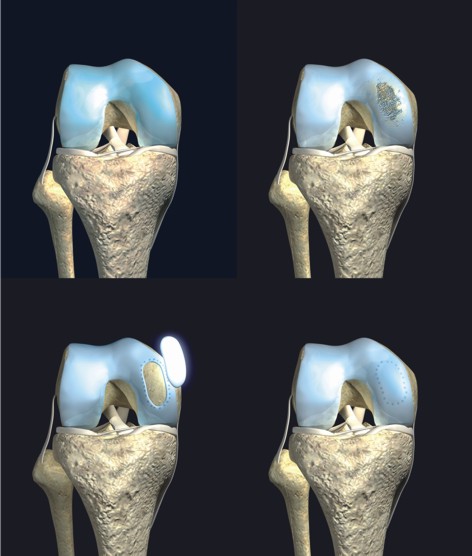 CaReS ® Ortho Zentrum Saar